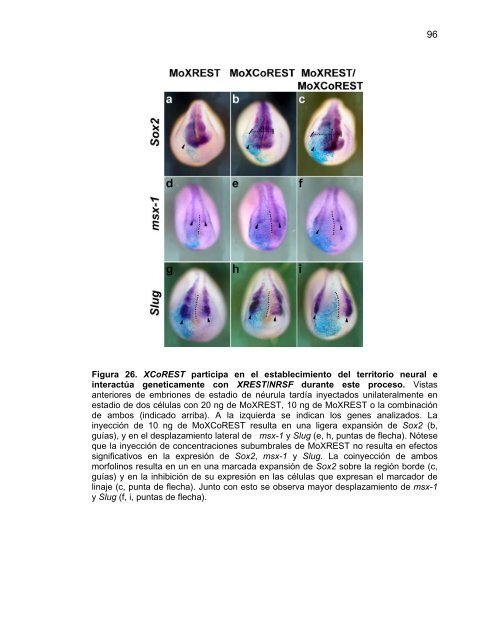 Participación del Factor Silenciador Neuronal Restrictivo - Tesis ...