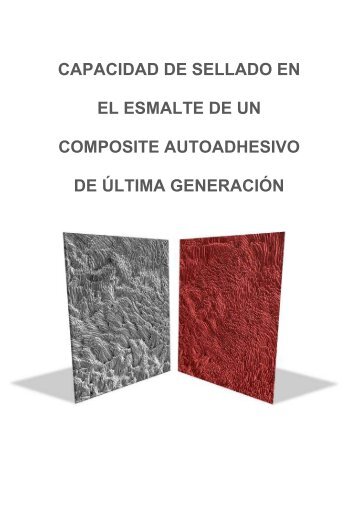 capacidad de sellado en el esmalte de un composite autoadhesivo ...