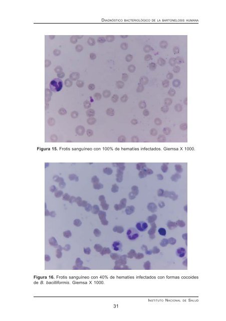 diagnóstico bacteriológico de la bartonelosis humana o enfermedad ...