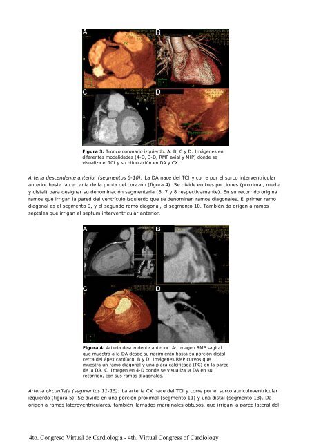 Anatomía de las arterias coronarias con Tomografia Computada - FaC