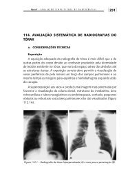 [251] 114. AVALIAÇÃO SISTEMÁTIcA dE RAdIOGRAFIAS dO TÓRAX