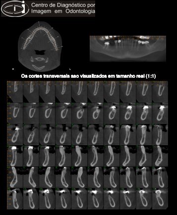 Os cortes transversais sao visualizados em tamanho real (1:1)