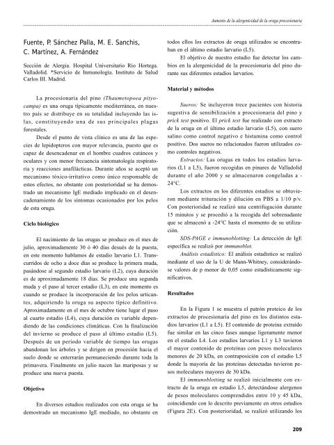 Infiltrados pulmonares eosinófilos - Alergología e Inmunología Clínica