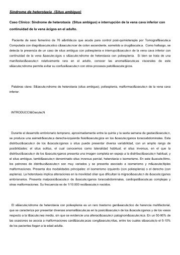 Síndrome de heterotaxia (Situs ambiguo) - Diagnostico Journal