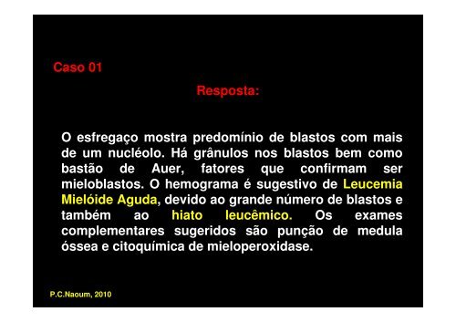 leucemias e outras doenças proliferativas