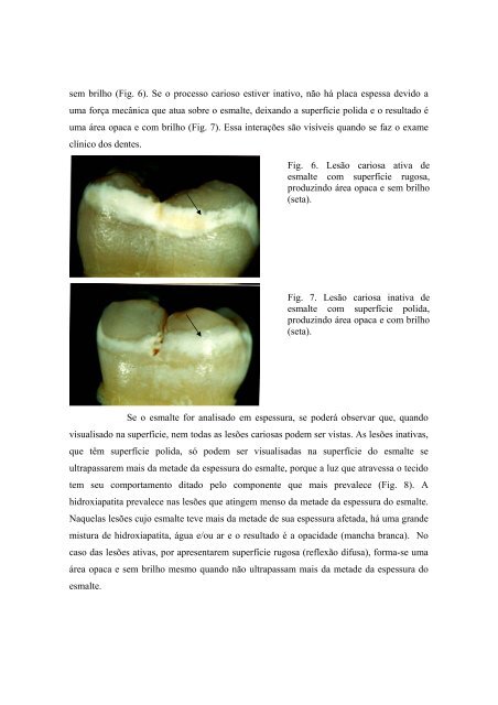 2 FÍSICA ÓTICA APLICADA AOS TECIDOS DENTAIS DUROS - CCS