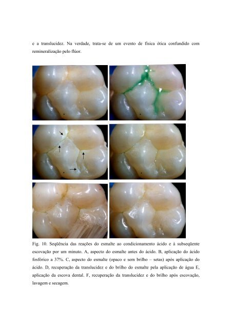 2 FÍSICA ÓTICA APLICADA AOS TECIDOS DENTAIS DUROS - CCS