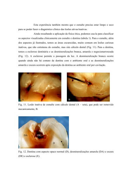 2 FÍSICA ÓTICA APLICADA AOS TECIDOS DENTAIS DUROS - CCS