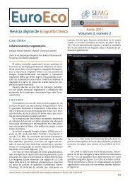 Revista digital de Ecografía Clínica - Revista Euroeco