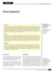 Ptosis palpebral - Nexus Médica