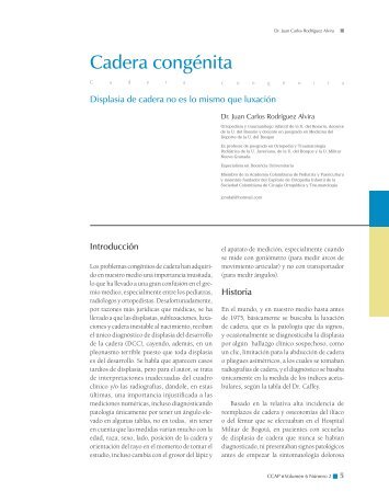 Cadera congénita - Sociedad Colombiana de Pediatria