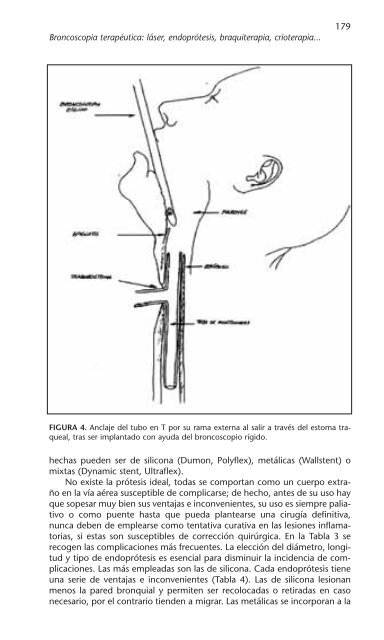 PATOLOGÍA RESPIRATORIA - Neumomadrid