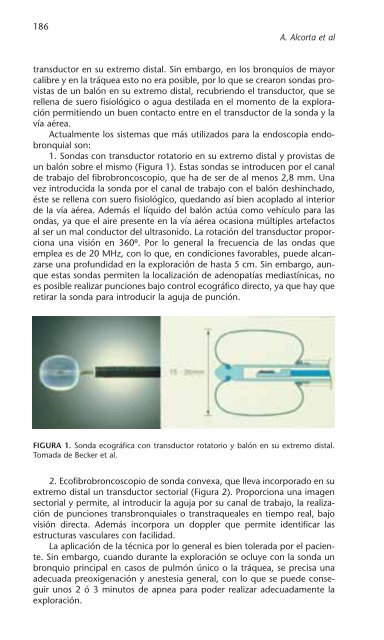 PATOLOGÍA RESPIRATORIA - Neumomadrid