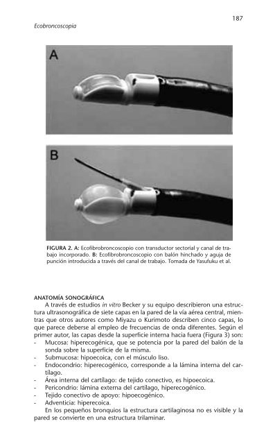 PATOLOGÍA RESPIRATORIA - Neumomadrid