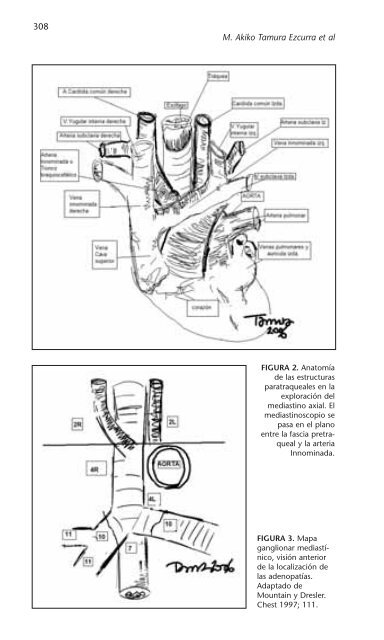 PATOLOGÍA RESPIRATORIA - Neumomadrid