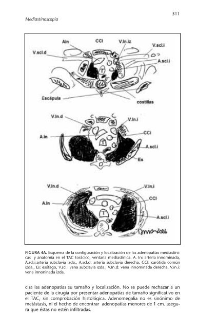 PATOLOGÍA RESPIRATORIA - Neumomadrid