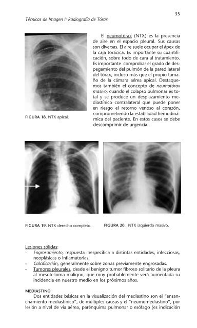 PATOLOGÍA RESPIRATORIA - Neumomadrid