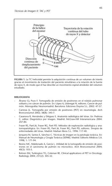 PATOLOGÍA RESPIRATORIA - Neumomadrid