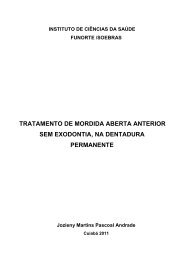 tratamento de mordida aberta anterior sem exodontia, na ... - Funorte