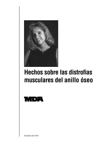 Hechos sobre las distrofias musculares del anillo oseo - MDA