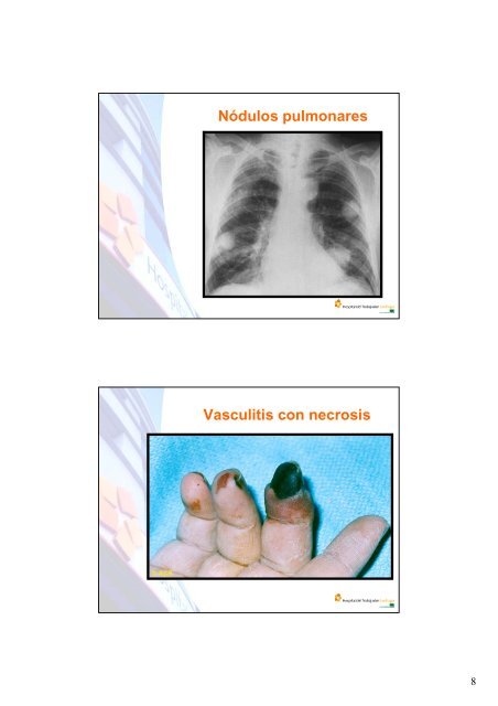 Exposición Dr. Alejandro Badilla, especialista en artritis ... - Sofofa