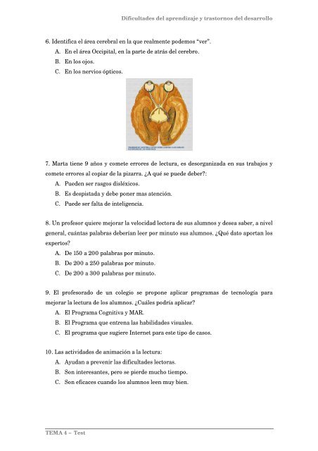 Cómo superar las dificultades de la Lectura: funciones visuales y ...