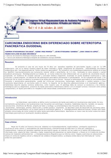 carcinoma endocrino bien diferenciado sobre heterotopia