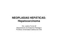 (Microsoft PowerPoint - neoplasias hep\341ticas3.ppt) - Sociedad ...