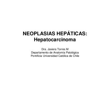 (Microsoft PowerPoint - neoplasias hep\341ticas3.ppt) - Sociedad ...