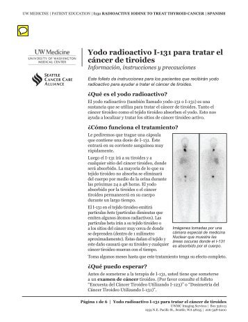 Yodo radioactivo I-131 para tratar el cáncer de tiroides