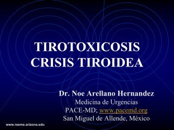 TIROTOXICOSIS CRISIS TIROIDEA