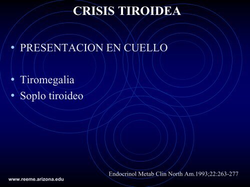 TIROTOXICOSIS CRISIS TIROIDEA