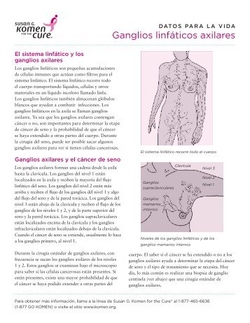 Ganglios linfáticos axilares - Susan G. Komen for the Cure