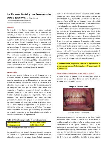 La Abrasión Dental y sus Consecuencias para la Salud Oral. Por ...