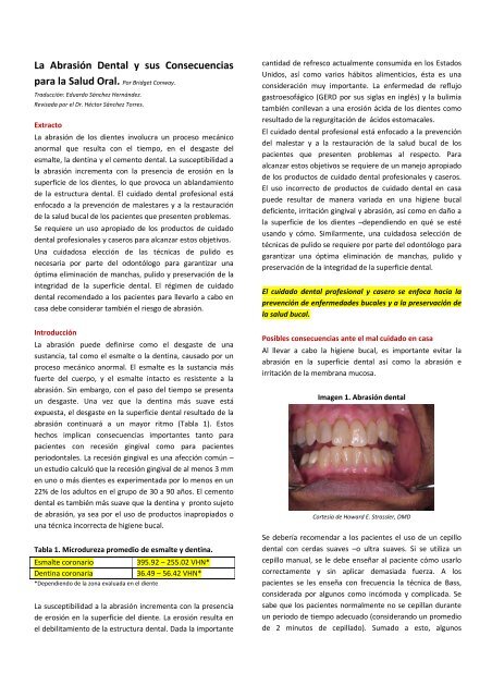 La Abrasión Dental y sus Consecuencias para la Salud Oral. Por ...