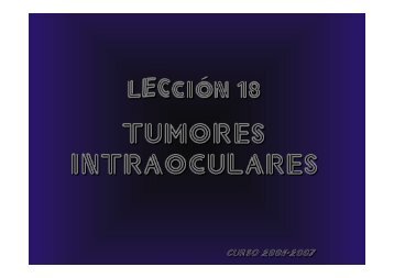 Tumores intraoculares Tumores intraoculares