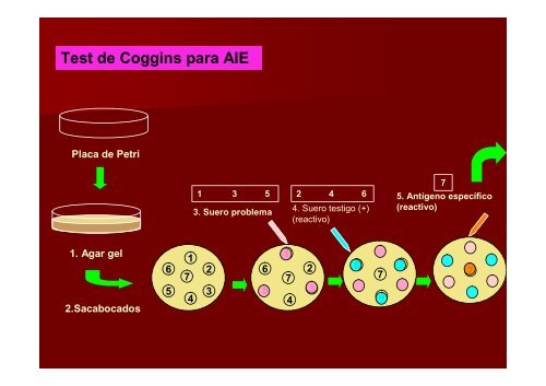 Clase IX