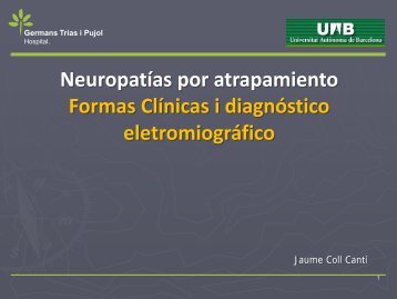 NEUROPATIA POR ATRAPAMIENTO