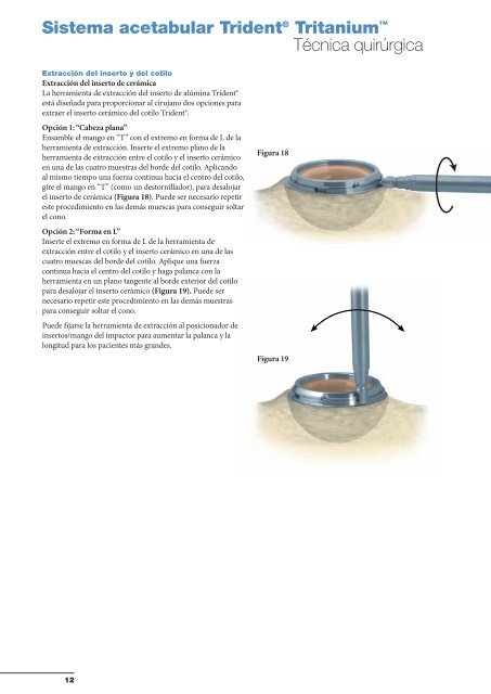 Sistema acetabular Trident® Tritanium™ - quirofano de Trauma