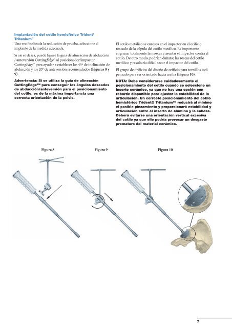 Sistema acetabular Trident® Tritanium™ - quirofano de Trauma