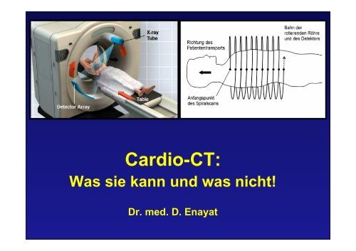 Cardio-CT: