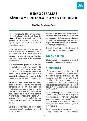 HIDROCEFALIAS SÍNDROME DE COLAPSO VENTRICULAR