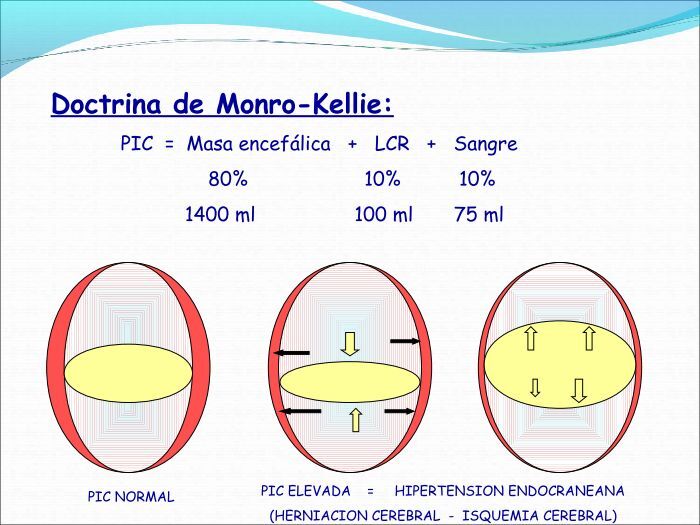 la doctrina de monro kellie