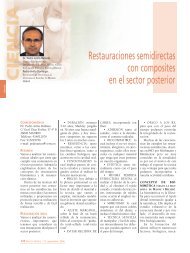 Restauraciones semidirectas con composites en el ... - Gaceta Dental