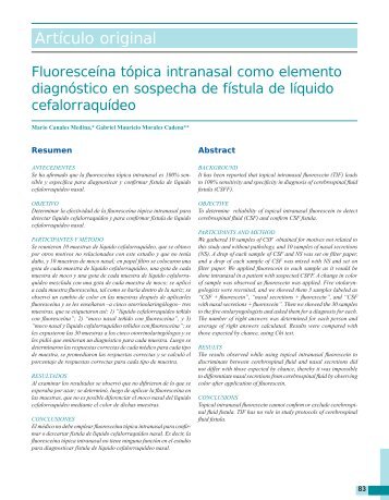 Fluoresceína tópica intranasal como elemento diagnóstico en ...