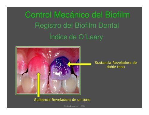 Control Mecánico de Biofilm Dental Registro y Evaluación