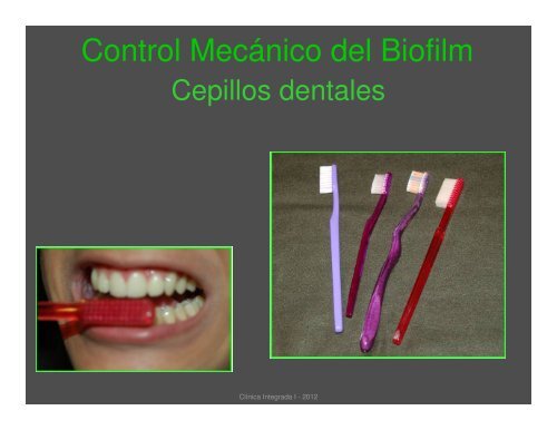 Control Mecánico de Biofilm Dental Registro y Evaluación