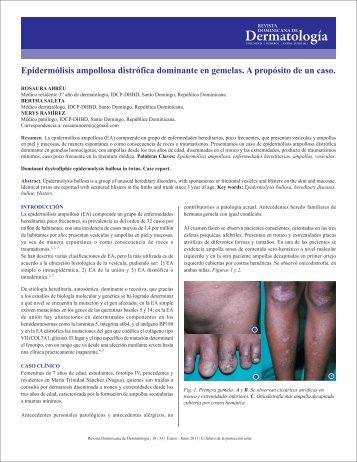 Ver PDF - Revista Dominicana de Dermatología