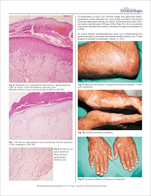 Ver PDF - Revista Dominicana de Dermatología