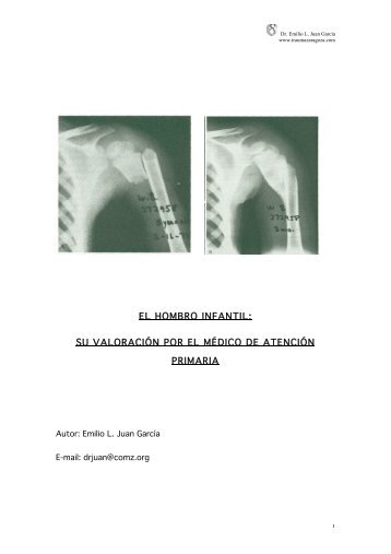 Hombro Infantil.pdf - Dr. Emilio L. Juan García